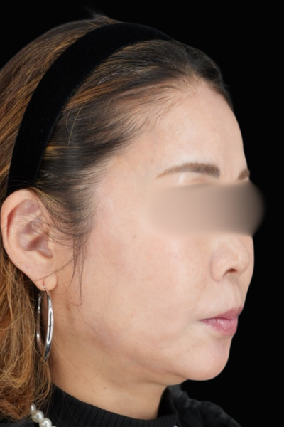 手術前の状態 その1