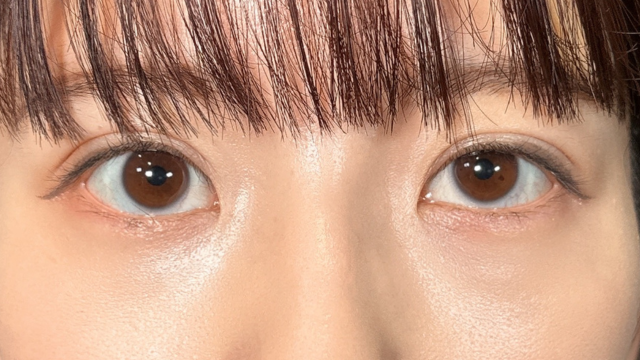 手术前的状态 其一