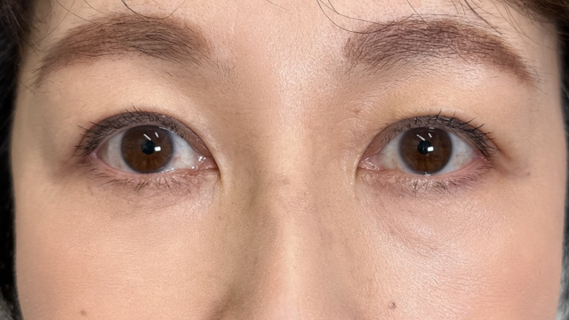 手术前的状态 其一