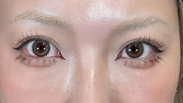 手术前的状态 其一