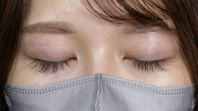 Postoperative Condition Part 1