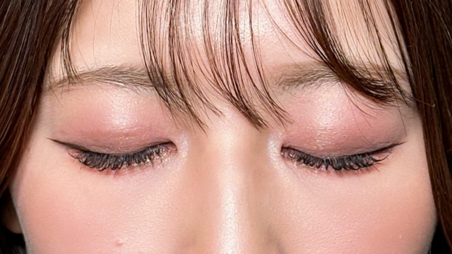 手术前的状态 其一