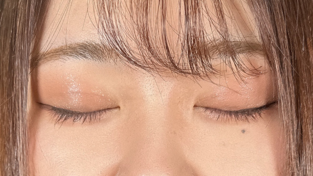 手术前的状态 其一