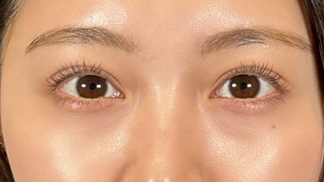 手术前的状态 其一