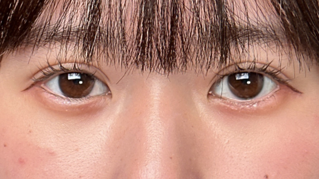 手术前的状态 其一