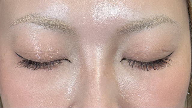 手术前的状态 其一