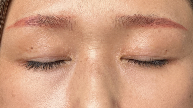 Postoperative Condition Part 1