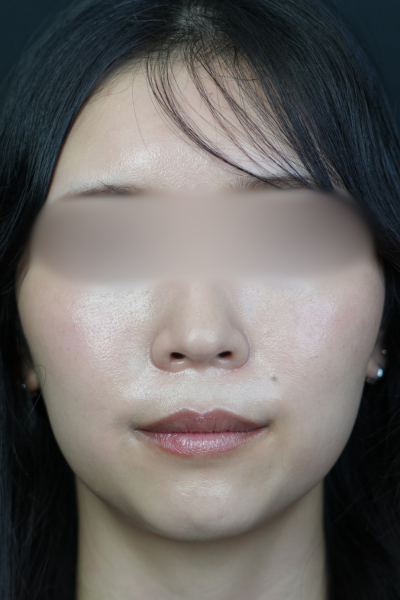 Postoperative Condition Part 1