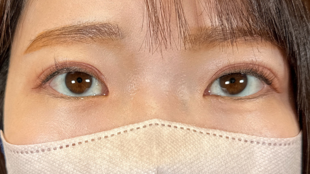 手术前的状态 其一