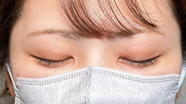 手术前的状态 其一