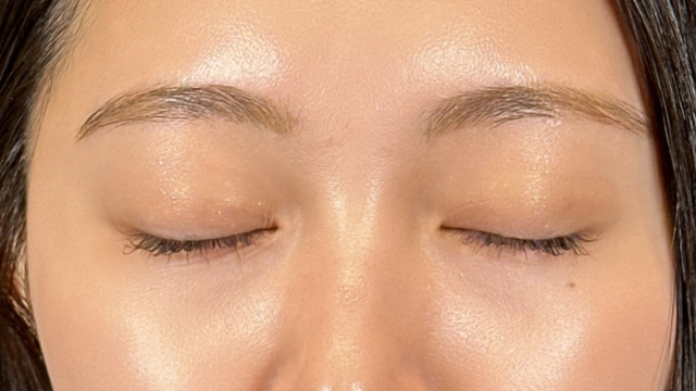 手术前的状态 其一