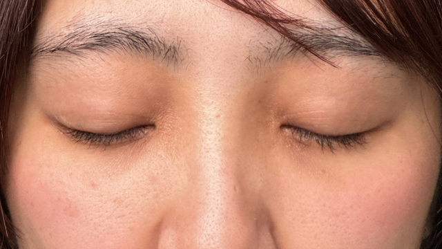 Postoperative Condition Part 1