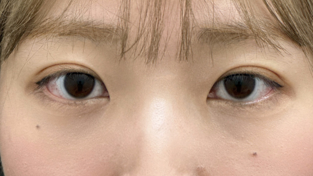 手术前的状态 其一