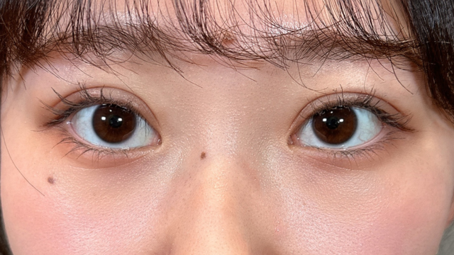 Postoperative Condition Part 1