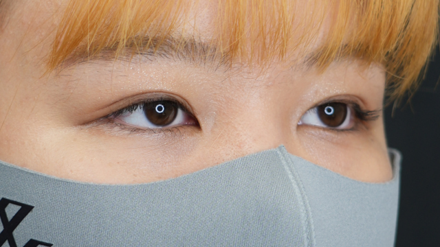 手术前的状态 其一