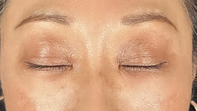 手術前の状態 その1