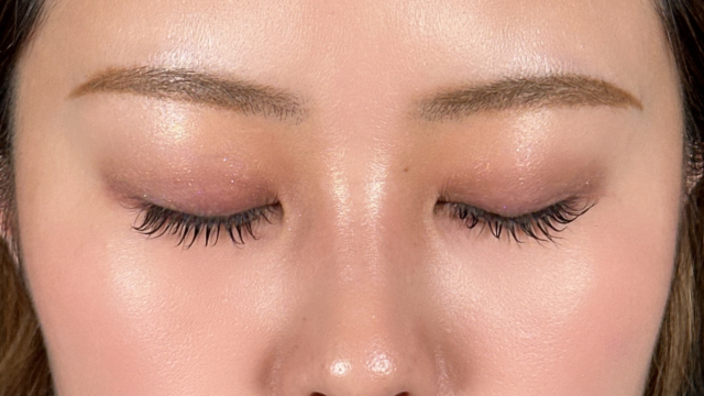 手术前的状态 其一