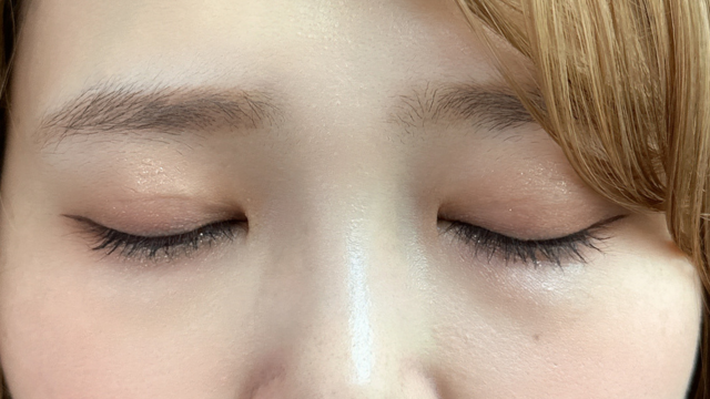 手术前的状态 其一