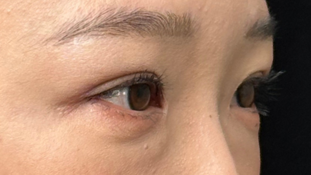 手术前的状态 其一