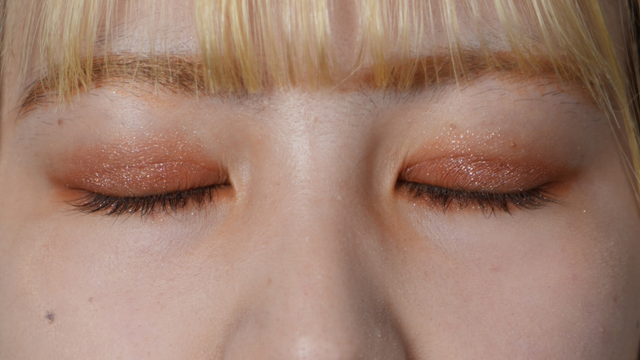 手術前の状態 その1