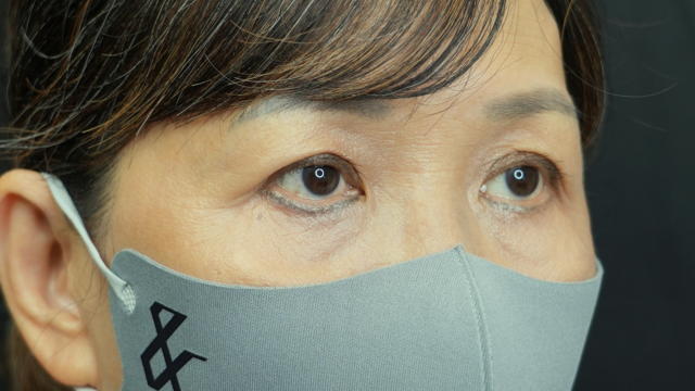 手术前的状态 其一