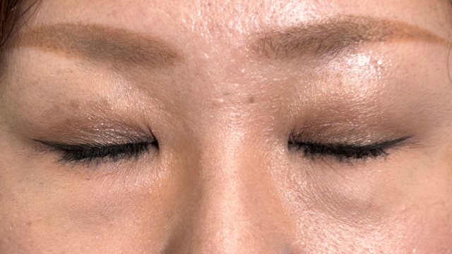 Postoperative Condition Part 1