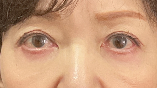 Postoperative Condition Part 1