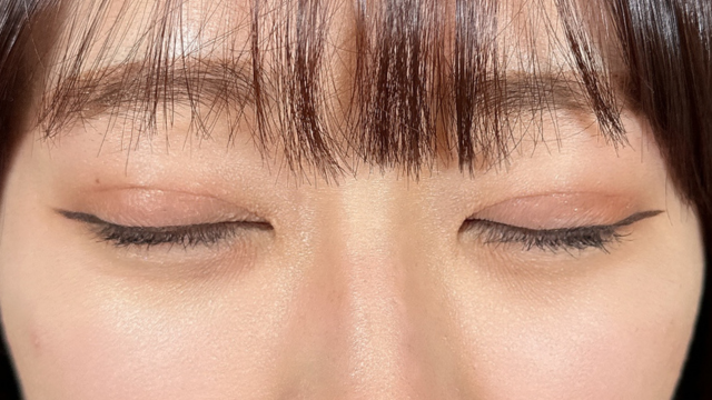 手术前的状态 其一