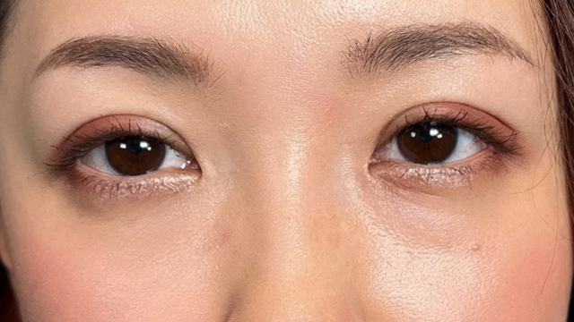 手术前的状态 其一