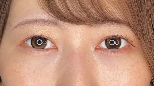 手术前的状态 其一