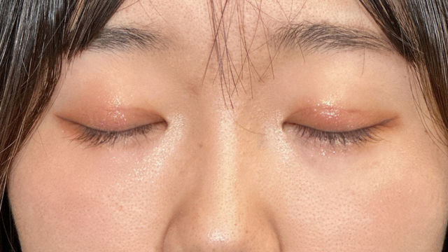 Postoperative Condition Part 1