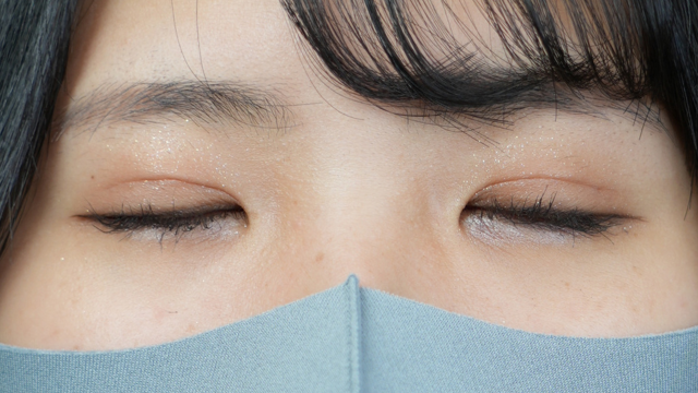 手术前的状态 其一