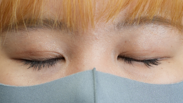 手术前的状态 其一