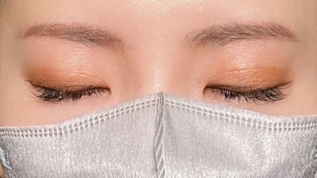 手术前的状态 其一