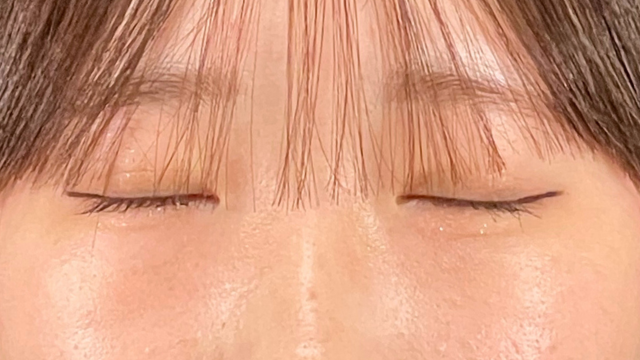 Postoperative Condition Part 1