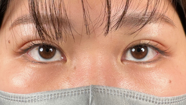 Postoperative Condition Part 1