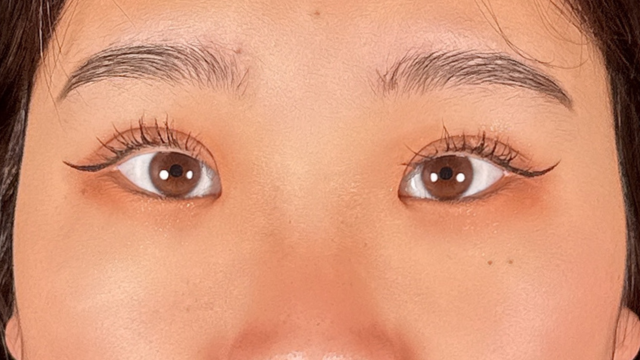 手术前的状态 其一