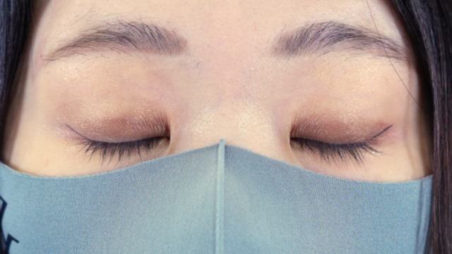 手术前的状态 其一