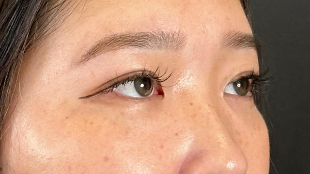 手术前的状态 其一