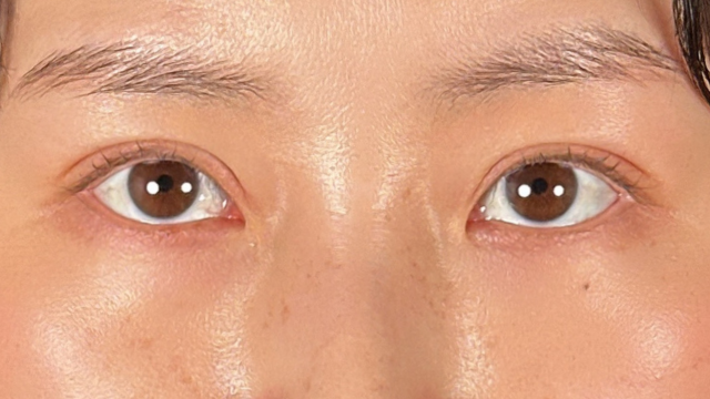 手术前的状态 其一