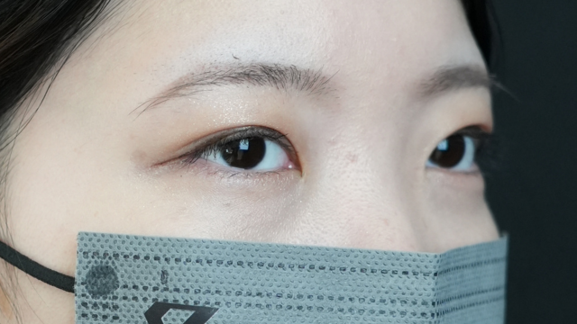 手术前的状态 其一