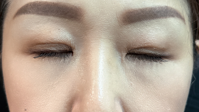 Postoperative Condition Part 1