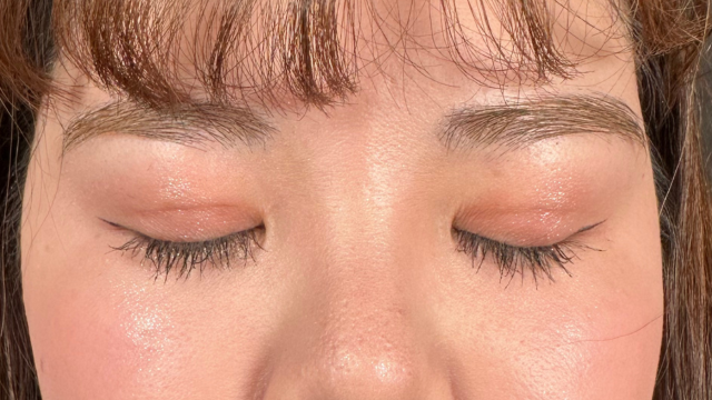 手术前的状态 其一