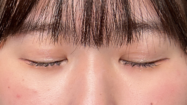 手术前的状态 其一