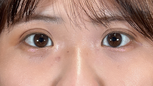 手术前的状态 其一