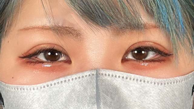 手术前的状态 其一