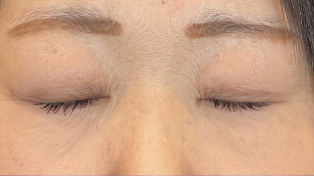 手术前的状态 其一