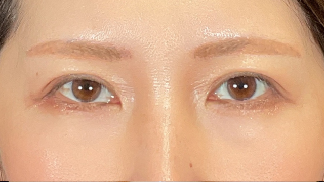 Postoperative Condition Part 1