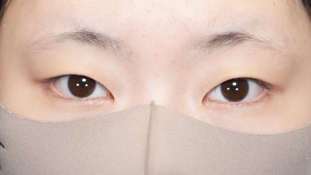 手术前的状态 其一