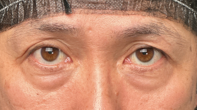 手术前的状态 其一